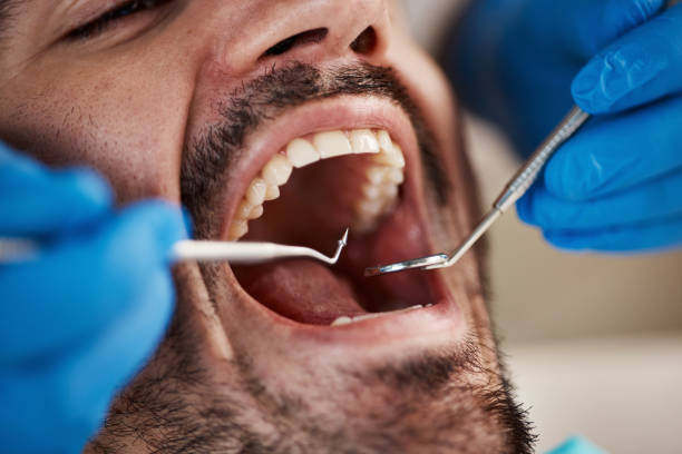 Best Dentist for Severe Toothache  in Willmsburg, IA
